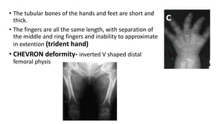 • The tubular bones of the hands and feet are short and
thick.
• The fingers are all the same length, with separation of
the middle and ring fingers and inability to approximate
in extention (trident hand)
• CHEVRON deformity- inverted V shaped distal
femoral physis
 