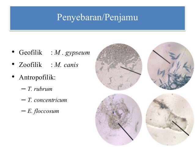 Skenario 20.5 Dermatofitosis & Non-dermatofitosis