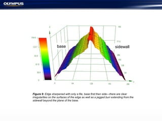 Figure 9: Edge sharpened with only a file, base first then side—there are clear
irregularities on the surfaces of the edge as well as a jagged burr extending from the
sidewall beyond the plane of the base.
base sidewall
 