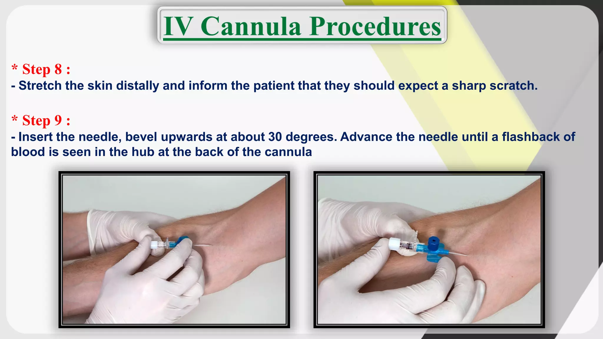 * Step 8 :
- Stretch the skin distally and inform the patient that they should expect a sharp scratch.
* Step 9 :
- Insert the needle, bevel upwards at about 30 degrees. Advance the needle until a flashback of
blood is seen in the hub at the back of the cannula
 