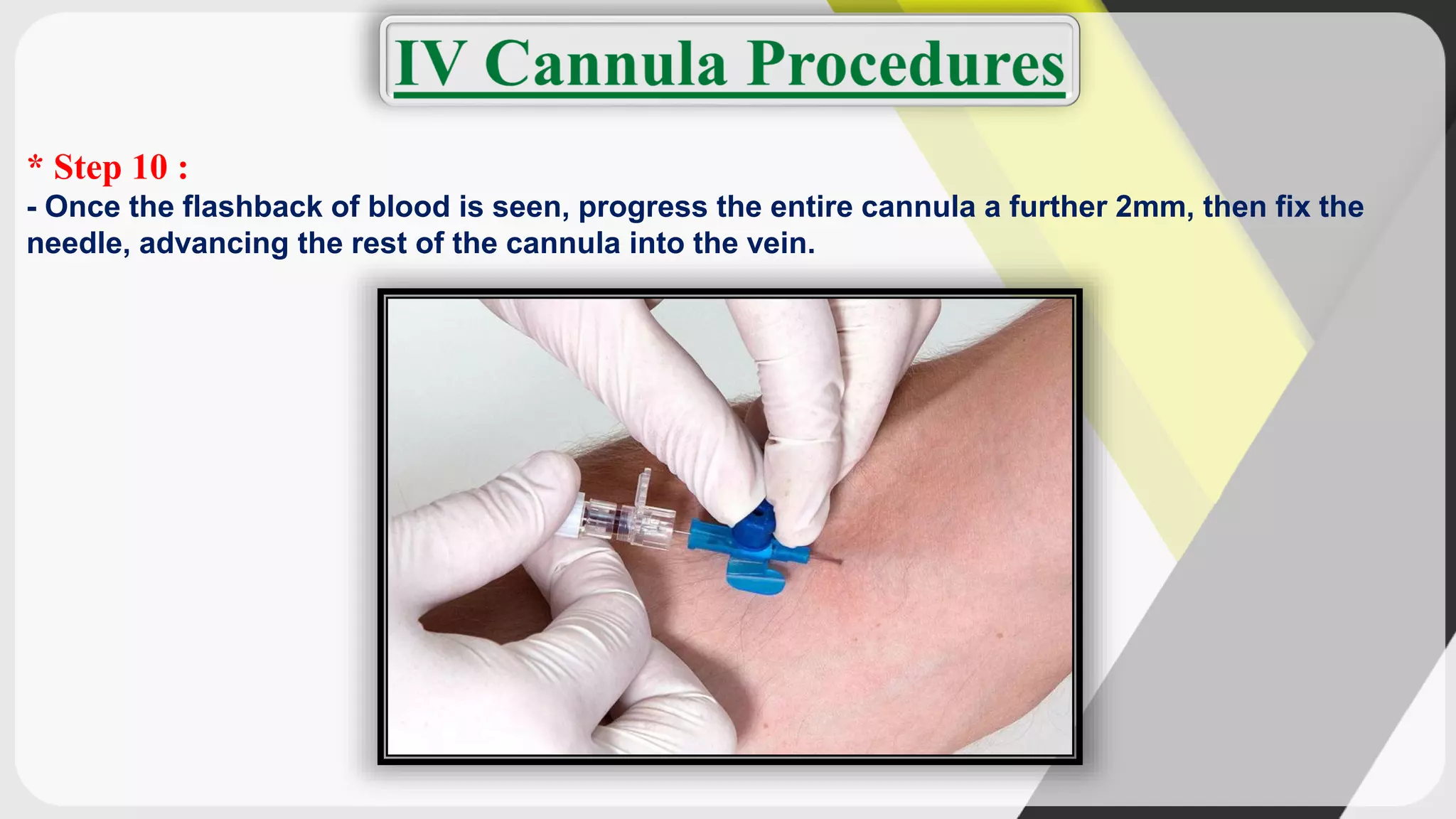 * Step 10 :
- Once the flashback of blood is seen, progress the entire cannula a further 2mm, then fix the
needle, advancing the rest of the cannula into the vein.
 