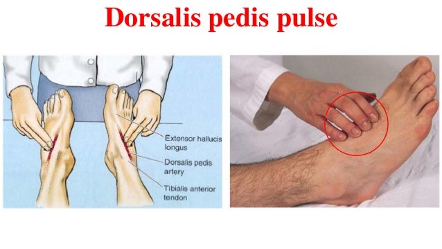 How To Find Pedal Pulse On Foot How To Find Pedal Pulse On Foot