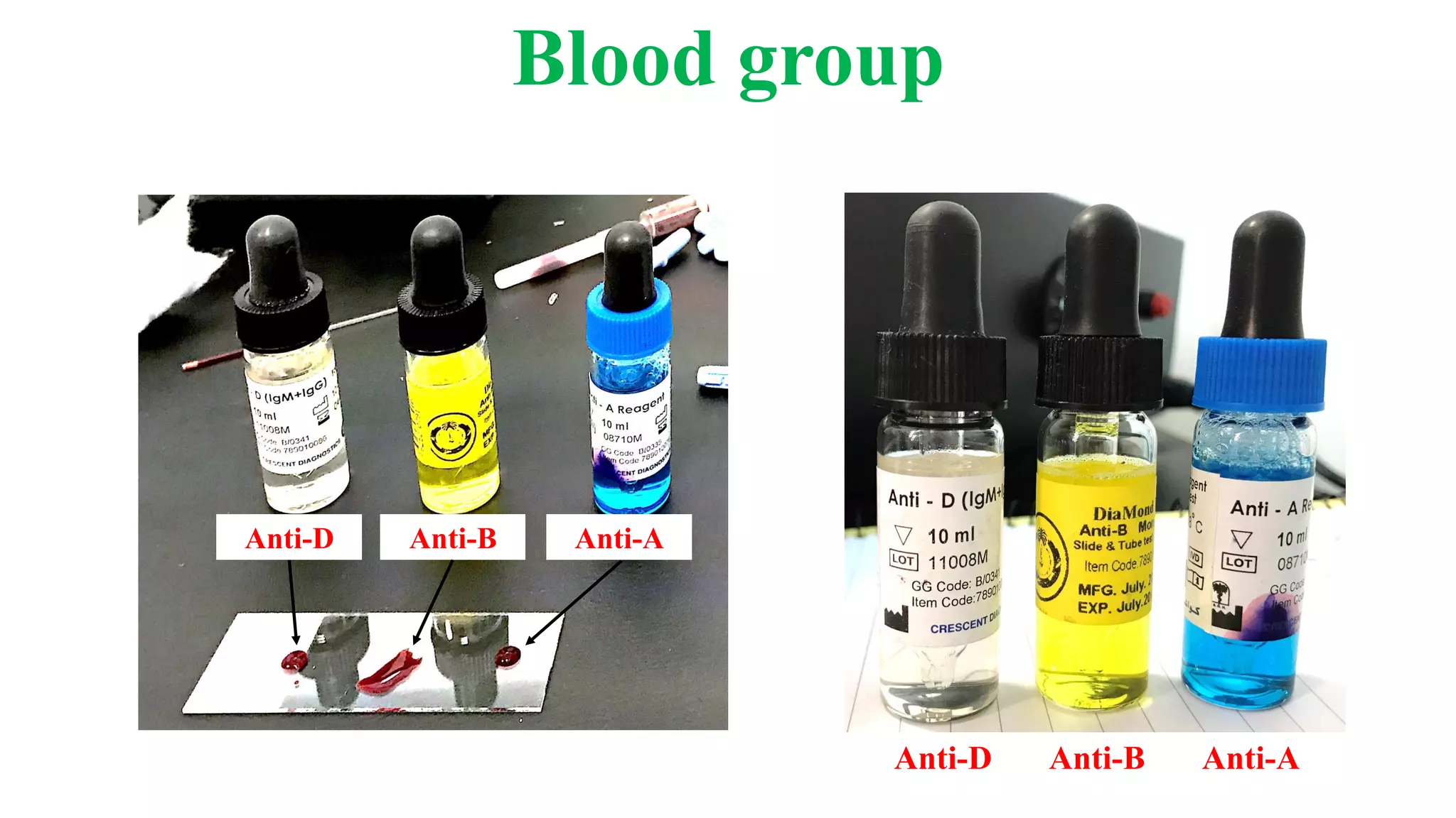 Anti-AAnti-BAnti-D
Anti-D Anti-B Anti-A
Blood group
 
