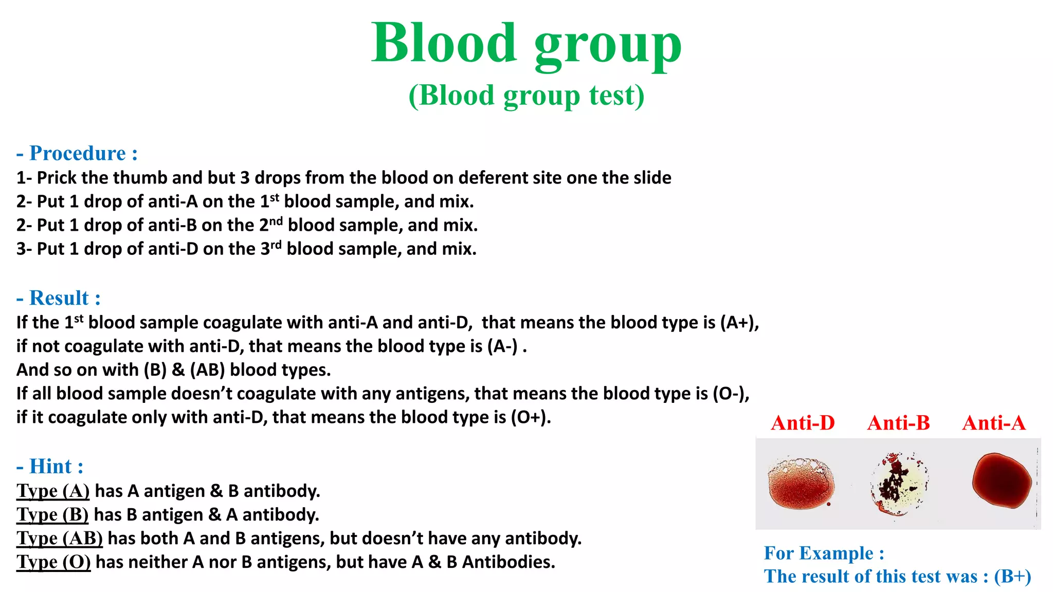 Blood group
(Blood group test)
- Procedure :
1- Prick the thumb and but 3 drops from the blood on deferent site one the slide
2- Put 1 drop of anti-A on the 1st blood sample, and mix.
2- Put 1 drop of anti-B on the 2nd blood sample, and mix.
3- Put 1 drop of anti-D on the 3rd blood sample, and mix.
- Result :
If the 1st blood sample coagulate with anti-A and anti-D, that means the blood type is (A+),
if not coagulate with anti-D, that means the blood type is (A-) .
And so on with (B) & (AB) blood types.
If all blood sample doesn’t coagulate with any antigens, that means the blood type is (O-),
if it coagulate only with anti-D, that means the blood type is (O+).
- Hint :
Type (A) has A antigen & B antibody.
Type (B) has B antigen & A antibody.
Type (AB) has both A and B antigens, but doesn’t have any antibody.
Type (O) has neither A nor B antigens, but have A & B Antibodies. For Example :
The result of this test was : (B+)
Anti-D Anti-B Anti-A
 