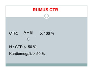 skill radiologi kardiovaskuler foto thorax | PDF