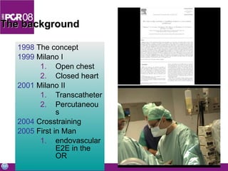 The background 1998  The concept 1999  Milano I Open chest Closed heart 2001  Milano II Transcatheter Percutaneous 2004  Crosstraining 2005  First in Man endovascular E2E in the OR 