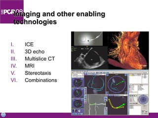 Imaging and other enabling technologies ICE 3D echo Multislice CT MRI Stereotaxis Combinations 