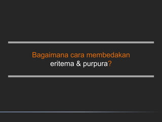 Bagaimana cara membedakan
eritema & purpura?
 