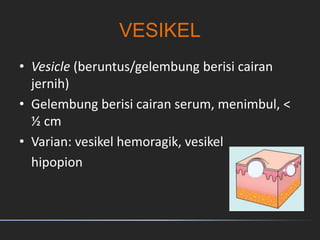 VESIKEL
• Vesicle (beruntus/gelembung berisi cairan
jernih)
• Gelembung berisi cairan serum, menimbul, <
½ cm
• Varian: vesikel hemoragik, vesikel
hipopion
 
