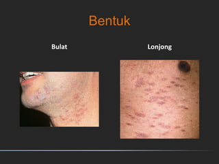 Bentuk
Bulat Lonjong
 