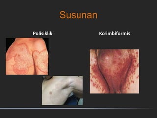 Susunan
Polisiklik Korimbiformis
 