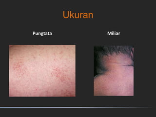 Ukuran
Pungtata Miliar
 