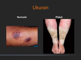 Ukuran
Numular Plakat
 