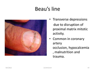 Beau’s line
                     • Transverse depressions
                        due to disruption of
                       proximal matrix mitotic
                       activity.
                     • Common in coronary
                       artery
                       occlusion, hypocalcemia
                       , malnutrition and
                       trauma.

8/5/2012      1212413114                     47
 