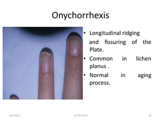 Onychorrhexis
                      • Longitudinal ridging
                        and ﬁssuring of the
                        Plate.
                      • Common in lichen
                        planus .
                      • Normal      in     aging
                        process.




8/5/2012       1212413114                     50
 