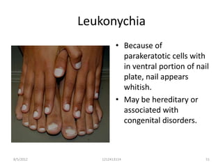 Leukonychia
                     • Because of
                       parakeratotic cells with
                       in ventral portion of nail
                       plate, nail appears
                       whitish.
                     • May be hereditary or
                       associated with
                       congenital disorders.



8/5/2012      1212413114                        51
 