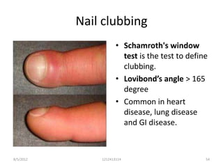 Nail clubbing
                      • Schamroth's window
                        test is the test to define
                        clubbing.
                      • Lovibond’s angle > 165
                        degree
                      • Common in heart
                        disease, lung disease
                        and GI disease.



8/5/2012       1212413114                        54
 