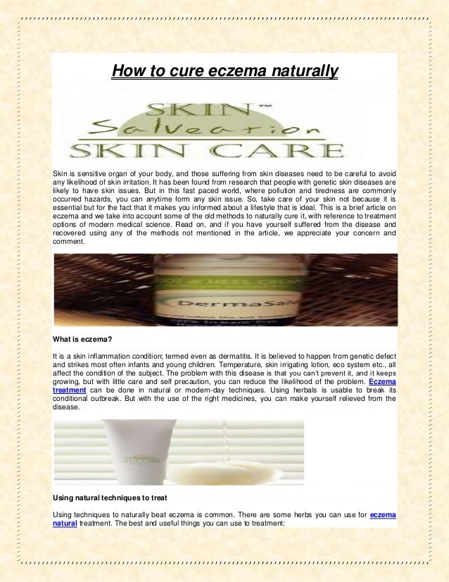 How to cure eczema naturally