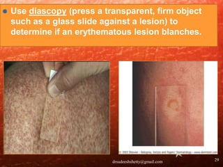Skin Examination Slide 29