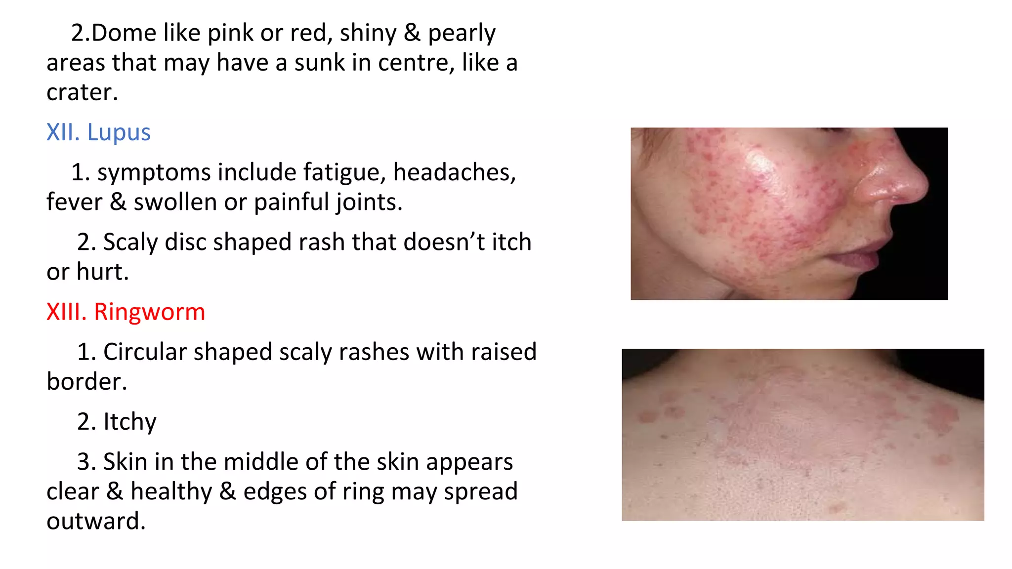 Pearly Rash Skin structure function and disease | PPT
