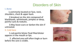 Disorders of Skin
I. Acne:
1.commonly located on face, neck,
shoulders, chest & upper back.
2.breakout on the skin composed of
blackheads, whiteheads, pimples or deep,
painful cysts & nodules.
3.May leave scars or darken the skin if
untreated.
II. Cold Sore
1.red painful blister fluid filled blister
appears in the mouth or lips.
2. affected area will often tingle or burn
before the sore is visible.
 