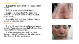 V. Actinic Keratosis
1. Less than 2 cm, or about the size of an
eraser.
2.thick, scaly, or crusty skin patch.
3. appears on parts of the body that
receive a lot of sun exposure(hands, feet,
scalp & neck).
4. usually pink in colour but can have a
brown tan or grey base.
VI. Rosacea
1. chronic skin disease, relapses triggers
by spicy food, alcohols, sunlight, & intestinal
bacteria Helicobacter pylori.
2. common symptoms include facial
flushing, raised, red bumps, facial redness,
skin dryness & skin sensitivity.
 