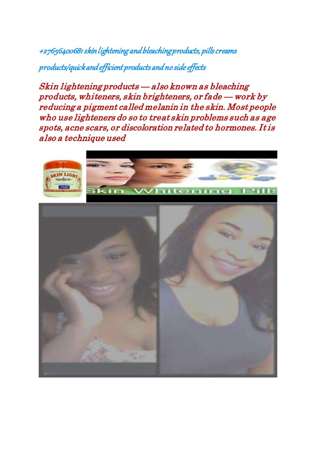 SKIN LIGHTENING AND BLEACHING PILLS CREAMS INJECTIONS & OILS CALL OR…