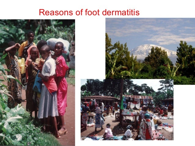 allergic skin diseases in tropical areas allergic skin diseases in tropical areas