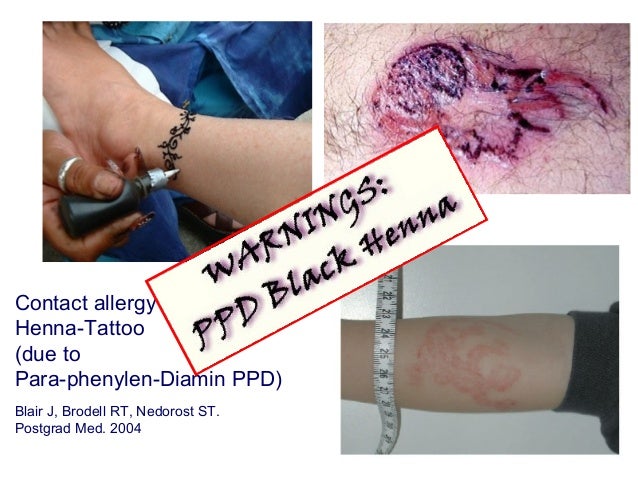 allergic skin diseases in tropical areas allergic skin diseases in tropical areas