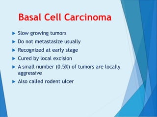 Basal Cell Carcinoma
 Slow growing tumors
 Do not metastasize usually
 Recognized at early stage
 Cured by local excision
 A small number (0.5%) of tumors are locally
aggressive
 Also called rodent ulcer
 