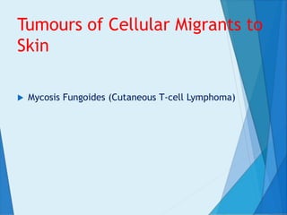 Tumours of Cellular Migrants to
Skin
 Mycosis Fungoides (Cutaneous T-cell Lymphoma)
 