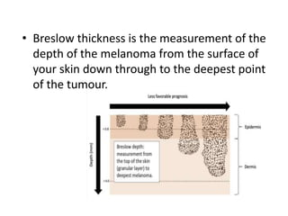 • Breslow thickness is the measurement of the
depth of the melanoma from the surface of
your skin down through to the deepest point
of the tumour.
 
