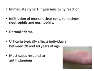 • Immediate (type 1) hypersensitivity reaction.
• Infiltration of mononuclear cells, sometimes
neutrophils and eosinophils.
• Dermal edema.
• Urticaria typically affects individuals
between 20 and 40 years of age.
• Most cases respond to
antihistamines.
 