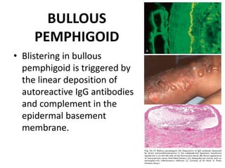 BULLOUS
PEMPHIGOID
• Blistering in bullous
pemphigoid is triggered by
the linear deposition of
autoreactive IgG antibodies
and complement in the
epidermal basement
membrane.
 