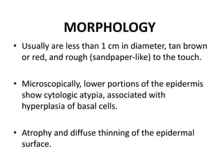 MORPHOLOGY
• Usually are less than 1 cm in diameter, tan brown
or red, and rough (sandpaper-like) to the touch.
• Microscopically, lower portions of the epidermis
show cytologic atypia, associated with
hyperplasia of basal cells.
• Atrophy and diffuse thinning of the epidermal
surface.
 
