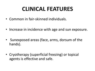 CLINICAL FEATURES
• Common in fair-skinned individuals.
• Increase in incidence with age and sun exposure.
• Sunexposed areas (face, arms, dorsum of the
hands).
• Cryotherapy (superficial freezing) or topical
agents is effective and safe.
 