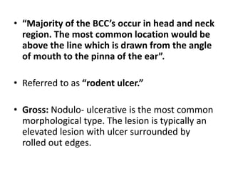 • “Majority of the BCC’s occur in head and neck
region. The most common location would be
above the line which is drawn from the angle
of mouth to the pinna of the ear”.
• Referred to as “rodent ulcer.”
• Gross: Nodulo- ulcerative is the most common
morphological type. The lesion is typically an
elevated lesion with ulcer surrounded by
rolled out edges.
 