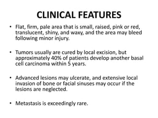 CLINICAL FEATURES
• Flat, firm, pale area that is small, raised, pink or red,
translucent, shiny, and waxy, and the area may bleed
following minor injury.
• Tumors usually are cured by local excision, but
approximately 40% of patients develop another basal
cell carcinoma within 5 years.
• Advanced lesions may ulcerate, and extensive local
invasion of bone or facial sinuses may occur if the
lesions are neglected.
• Metastasis is exceedingly rare.
 