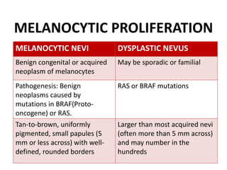 MELANOCYTIC PROLIFERATION
MELANOCYTIC NEVI DYSPLASTIC NEVUS
Benign congenital or acquired
neoplasm of melanocytes
May be sporadic or familial
Pathogenesis: Benign
neoplasms caused by
mutations in BRAF(Proto-
oncogene) or RAS.
RAS or BRAF mutations
Tan-to-brown, uniformly
pigmented, small papules (5
mm or less across) with well-
defined, rounded borders
Larger than most acquired nevi
(often more than 5 mm across)
and may number in the
hundreds
 