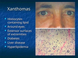 All about the pathology and diseases ofkin.ppt