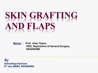 SKIN GRAFTING
AND FLAPS
By
Sattradhaja Keisham
8th sem MBBS, NEIGRIHMS
Mentor : Prof. Noor Topno
HOD, Department of General Surgery,
NEIGRIHMS
 