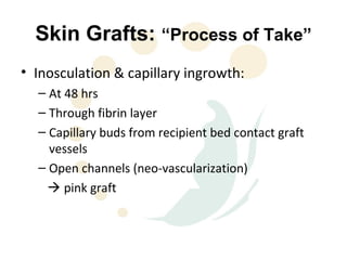 Skin Grafts: “Process of Take”
• Inosculation & capillary ingrowth:
  – At 48 hrs
  – Through fibrin layer
  – Capillary buds from recipient bed contact graft
    vessels
  – Open channels (neo-vascularization)
     pink graft
 