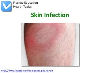 Fitango Education
          Health Topics

                        Skin Infection




http://www.fitango.com/categories.php?id=69
 