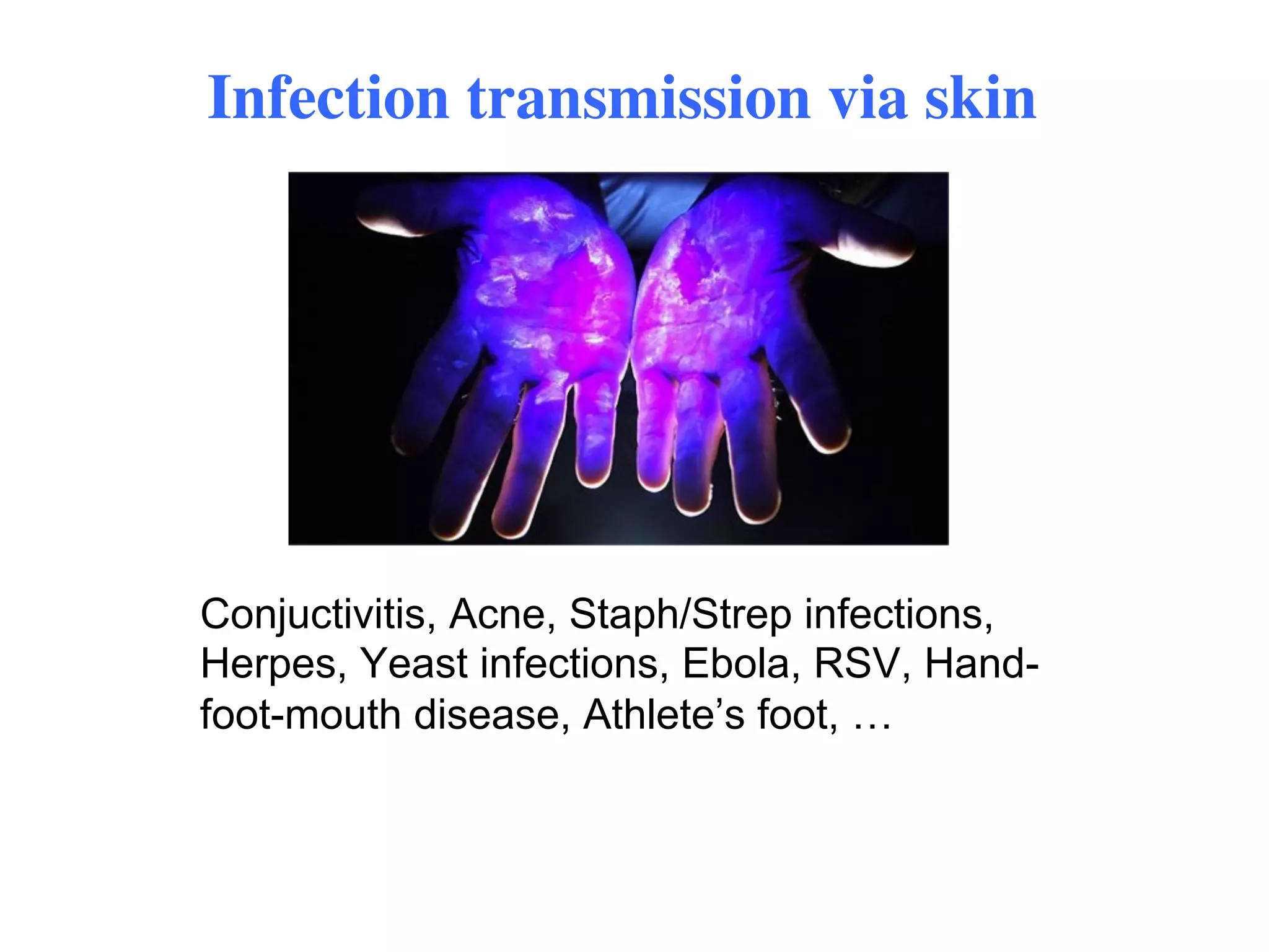The Role of the Skin Microbiome in Atopic Dermatitis (Eczema) | PDF