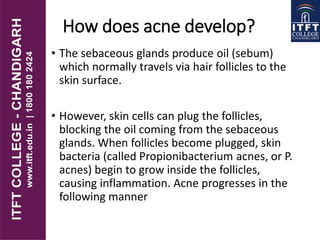 How does acne develop?
• The sebaceous glands produce oil (sebum)
which normally travels via hair follicles to the
skin surface.
• However, skin cells can plug the follicles,
blocking the oil coming from the sebaceous
glands. When follicles become plugged, skin
bacteria (called Propionibacterium acnes, or P.
acnes) begin to grow inside the follicles,
causing inflammation. Acne progresses in the
following manner
 