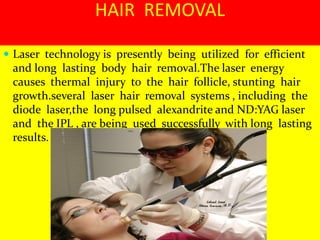  Laser technology is presently being utilized for efficient
and long lasting body hair removal.The laser energy
causes thermal injury to the hair follicle, stunting hair
growth.several laser hair removal systems , including the
diode laser,the long pulsed alexandrite and ND:YAG laser
and the IPL , are being used successfully with long lasting
results.
HAIR REMOVAL
 