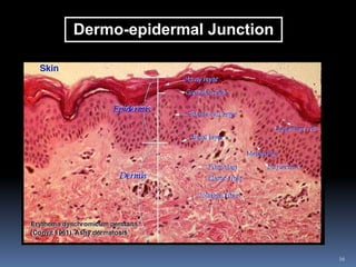 16
Dermo-epidermal Junction
 