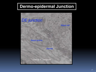 17
Dermo-epidermal Junction
 