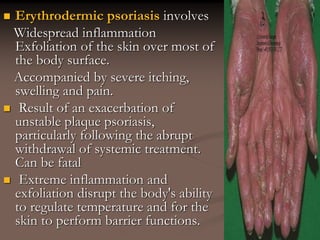  Erythrodermic psoriasis involves
Widespread inflammation
Exfoliation of the skin over most of
the body surface.
Accompanied by severe itching,
swelling and pain.
 Result of an exacerbation of
unstable plaque psoriasis,
particularly following the abrupt
withdrawal of systemic treatment.
Can be fatal
 Extreme inflammation and
exfoliation disrupt the body's ability
to regulate temperature and for the
skin to perform barrier functions.
 