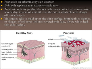  Psoriasis is an inflammatory skin disorder
 Skin cells replicate at an extremely rapid rate.
 New skin cells are produced about eight times faster than normal--over
several days instead of a month--but the rate at which old cells slough
off is unchanged.
 This causes cells to build up on the skin's surface, forming thick patches,
or plaques, of red sores (lesions) covered with flaky, silvery-white dead
skin cells (scales).
 